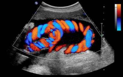 Naveena Hospital Colour Doppler
