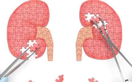 Naveena Hospital Neurology Dialysis