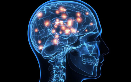 Naveena Hospital Neurology